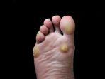 kaki-kapalan.jpg