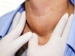 kanker-tiroid-4.jpg