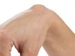kista-ganglion-adalah-benjolan-berisi-cairan-yang-terjadi-di-dekat-sendi-atau-tendon-s.jpg