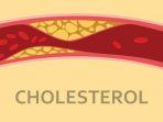 kolesterol-11.jpg