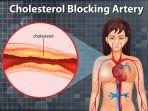 kolesterol-36.jpg