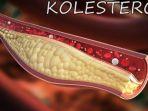 kolesterol-5.jpg
