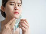 kulit-kusam-dan-berjerawat-akibat-penggunaan-masker.jpg