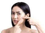 kulit-sensitif-5.jpg