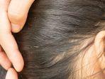 kutu-rambut-1.jpg