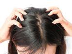 kutu-rambut23.jpg