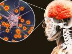 mengenal-meningitis.jpg