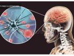 meningitis-5.jpg