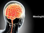 meningitis-8.jpg