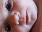 milia-pada-bayi-2.jpg