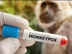 monkeypox-ilustrasi.jpg