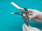 pap-smear-4.jpg