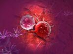perbedaan-kanker-dan-tumor.jpg