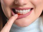 periodontitis-5.jpg