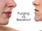 purging-2.jpg