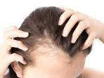 rambut-rontok-5.jpg