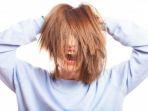 rambut-rontok6.jpg