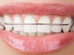 retainer-10.jpg