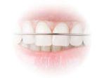retainer-2.jpg