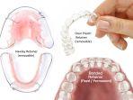 retainer-4.jpg