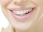 retainer-5.jpg
