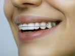 retainer-7.jpg