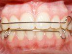retainer-9.jpg