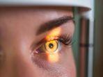 retina-mata-lepas-1.jpg