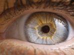retina-mata-lepas-3.jpg