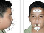 reverse-pull-headgear-atau-facemask-1.jpg