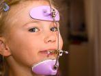 reverse-pull-headgear-atau-facemask-3.jpg