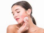 rosacea2.jpg