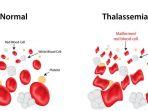 sel-darah-thalasemia.jpg