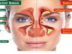 sinus.jpg