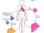 skema-imunoterapi-sel-t-dan-proses-adopsi-limfosit-infiltrasi-tumor-atau-rekayasa-terapi-sel-t.jpg