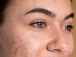 skin-barrier-8.jpg