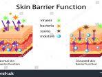skin-barrier4.jpg