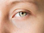 softlens.jpg
