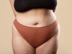 stretchmark-7.jpg