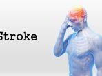 stroke-10.jpg