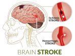 stroke-4.jpg