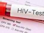 test-hiv.jpg