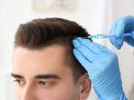 transplantasi-rambut-2.jpg