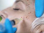 treatment-prp.jpg