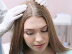 treatment-rambut-rontok.jpg