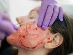 vampire-facial-2.jpg