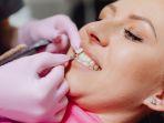 veneer-gigi-22.jpg