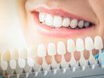 veneer-gigi-5.jpg