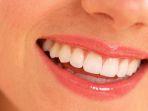 veneer-gigi-7.jpg
