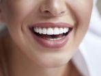 veneer-gigi-9.jpg